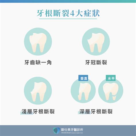 牙齒掉了|牙齒斷掉一定要拔掉嗎？牙根還在可以不拔嗎？